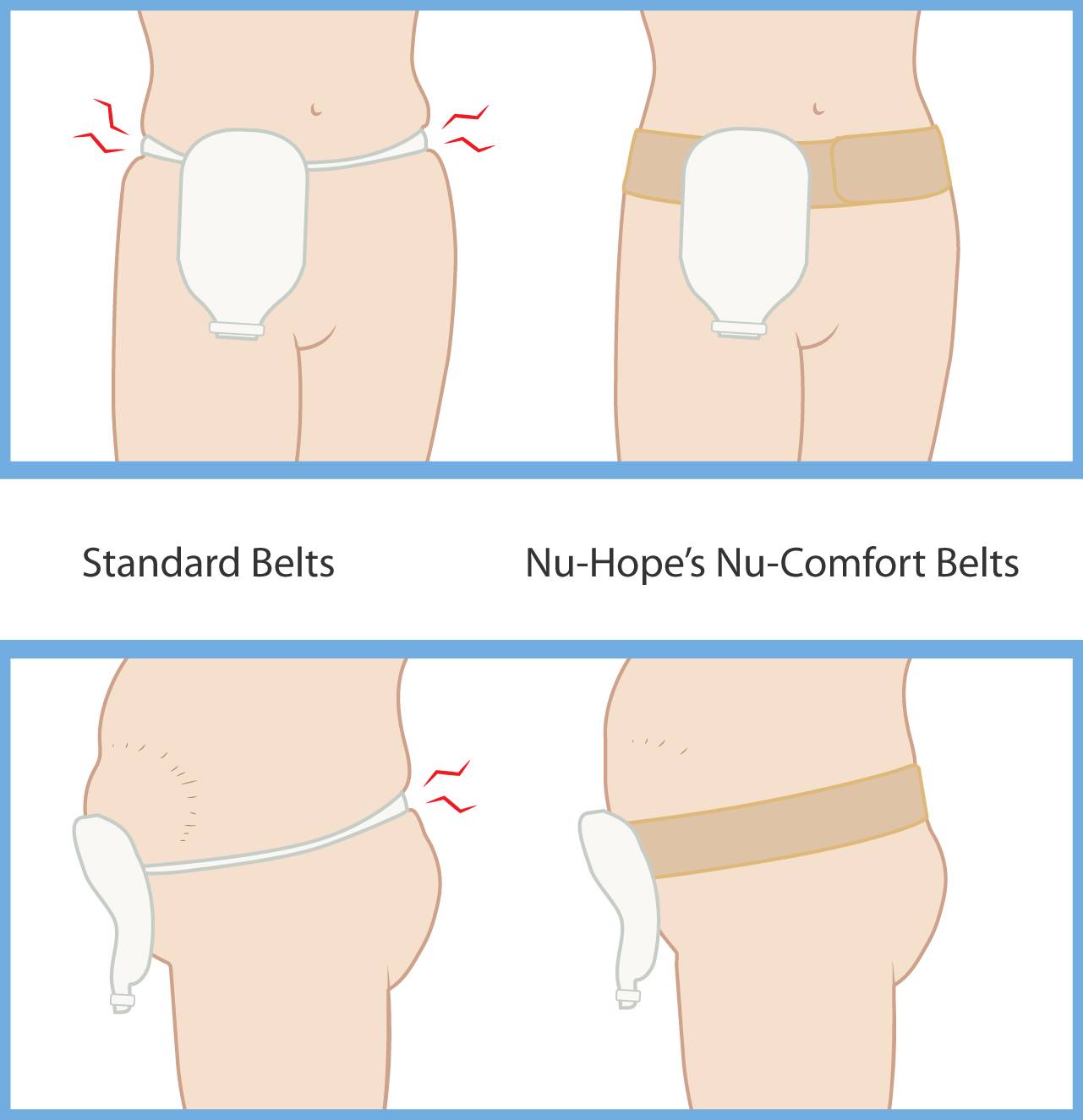 Nu-Hope Nu-Comfort ostomy belt